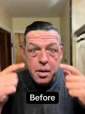 Peter Thomas Roth instant eye tightener #tiktokshoprestock #peterthomasroth #firmxeye #peterthomasrothinstantfirmeye #ptrbeforeafter #undereyebags #tiktokshoprestock #CapCut 
