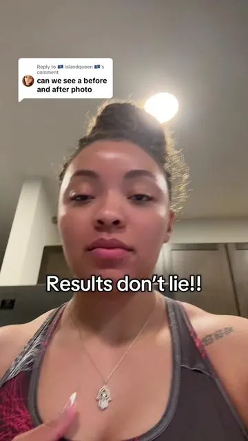 Replying to @🇬🇺 islandqueen 🇬🇺 hope this helps to showcase just how amazing this product is. I honestly am a little skeptical of it being legal to take this stuff because of how great it works 😂😂 . . . #yerba #yerbamate #yerbamagic #peachmango #yerbamatetok #beforeandafter #bloating #bloatingrelief #herbaltea #supplementsthatwork #fy  