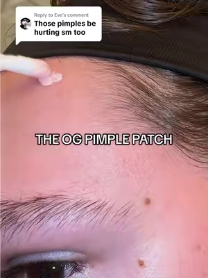Replying to @Eve flash sale ends tonight Mario Badescu drying lotion goated🙏🏼🙌🏼 #pimple #dryinglotion #acne #mariobadescu #skincareroutine #acnetreatment #tiktokmademebuyit #tiktokshoprestock #tiktokshopcreatorpicks #tiktokshopspringglowup #ttslevelup #springtok #ttsdelightnow #tiktokshopmothersday #tiktokshopmemorialday #ttscreatorbash 