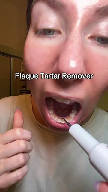 My teeth feel sooooo much better!!! You can get rid of that fuzzy grimy feeling at home #plaqueremoval #plaqueremover #tartarremover #dentalcare #oralcare #teethcleaning 