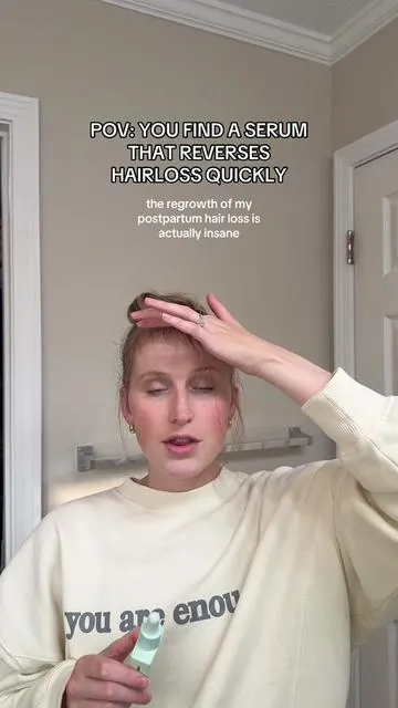 MAGIC IN A BOTTLE ✨ Divi has helped my postpartum hairloss SO MUCH. #postpartumhairloss #hairloss #hairlossremedy #divi #divihairserum #divihaircare #hairlosssolutions 