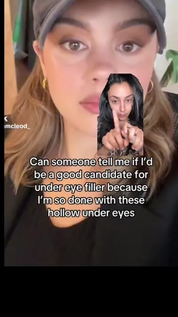 @Sasha McLeod try Volufiline, this brand or any brand just try Volufiline first ❤️❤️ #volufiline #volufilineserum #fillerinabottle #antiaging #fyp #viral #undereyefiller #teartoughfiller #teartroughfiller 