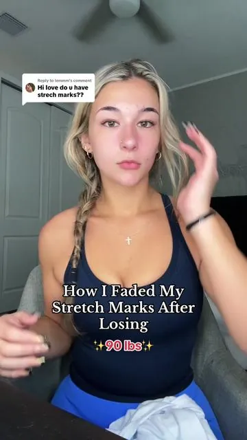 Replying to @Iemmm this is the product that helped me fade my ✨ stretch marks✨ #weightloss #fyp #transformation #bflat #skin #skintok #stretchmarks #looseskin #fatloss #tiktokshop #relatable #bellyfat #trending #weightlossjouney #fypシ #musthaves 