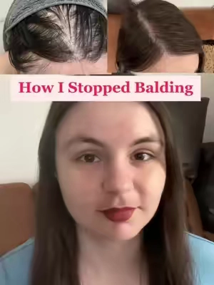 These three things worked so well for me personally #biotin #haircare #hairloss #womenshealth #supplements #tsubaki #hairgrowth 