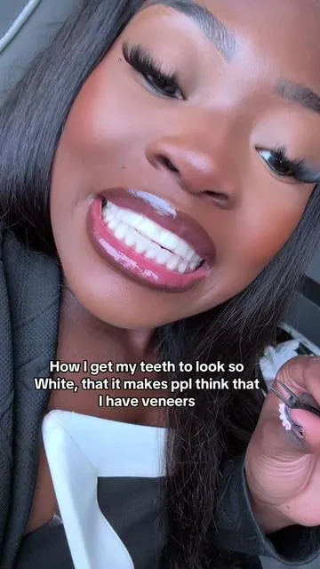 It’s been a while since I put on some teeth whitening strips but these are always gonna do the TRICK!!  #dentalhygienist #gurunanda #whiteningstrips #whiteteeth #whiteningthatworks #whiteningteeth #whitestrips #yellowteeth #whiteteeth #teeth #oralhygiene #gurunandawhiteningstrips #honestreview #GuruNandaGlowUp #GuruNandaSuperBrandDay 