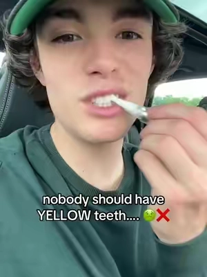 my teeth have never loooked this good 😳