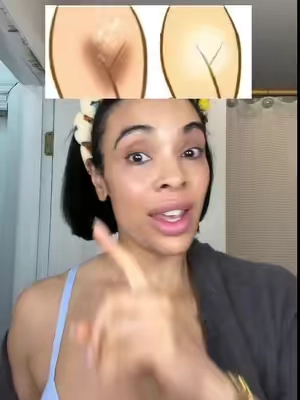 Dark spots on your bikini line, inner thighs, or knees? This brightening gel is gentle, effective, and actually works. #tiktokshopfinds#brighteninggel#darkspottreatment#divinederriere#ttsbeautybesties#tiktoksummerturnup#tiktokshopcreatorpicks 