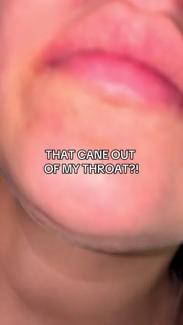 Something nice has finally helped remove my tonsil stones! #flosserwaterteeth 