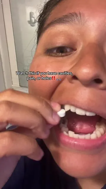 Is this not insane 🤯 #nobs #dentist #cavities #teethtok #teethcare #cavity #whiteteeth #nobstoothpaste #badbreath #smile #viraltiktok #blowthisup 