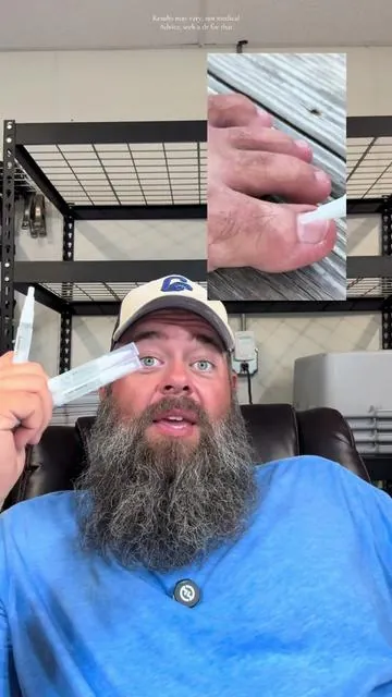 Best anti fungal there is!! #toes #toefungus #feet #footfungus #TikTokShopSummerTurnUp #CreatorIcons #TikTokShopCreatorPicks #TTSThunderbolt #HealthMustHaves #DealsForYouDays 