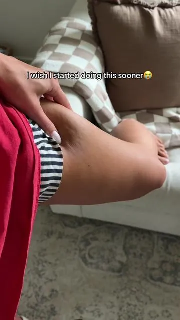 10-15 minutes of this everyday and I already see results🤭 #cellulite #cellulitemassage #cellulitereduction #celluliteisnormal #cellulitetips #massager 