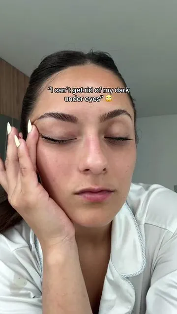 How to get rid of your dark under eye bags fast af 😭 shoutout to Korean skincare for always saving my life. I used the new Anua Caffeine under eye cream and it completely revived my under eyes!! They were my biggest insecurity #dealsforyoudays #koreanskincare #anuaskincare #darkundereye #eyebags 