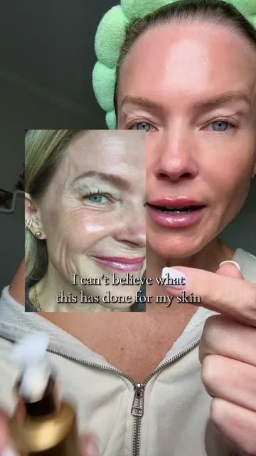 Dual effect PDRN ampoule from @REJURAN US has significantly reduced my crows feet and noticeably plumped my smile lines, in just 3 weeks! #rejuran #rejuranampoule #pdrnserum #rejurandualeffect #antiagingskincare #womenover50 #salmonpdrn #koreanskincare #crowsfeet #finelinesandwrinkles #dealsforyoudays #truegreta 