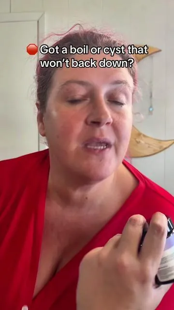 Boils, cysts, and ingrown nightmares? This salve draws it out fast—no more popping, pain, or mess. Powered by egg yolk extract & propolis 💛 #UniversalFlareCare #BoilRelief #TikTokShopCreatorPicks #SkinCareSOS #NaturalHealing  
