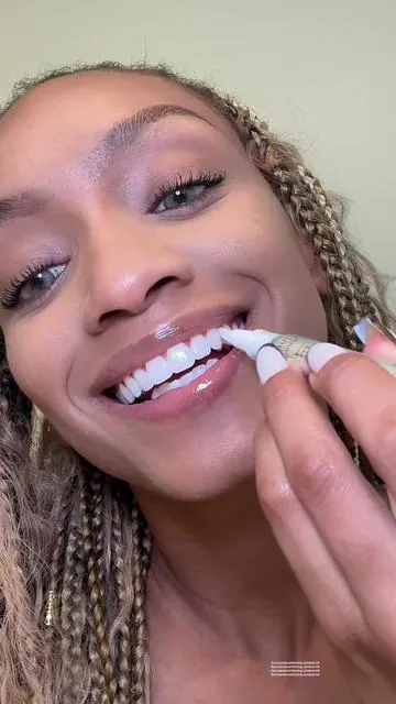 You don’t have to have yellow teeth, we got options baby! 😁  #gurunanda #teethwhitening #gurunandawirelesswhiteningnewarrival #dealsforyoudays #whiteteeth #whiteningstrips @GuruNanda LLC @Puneet Nanda bridge the gap 