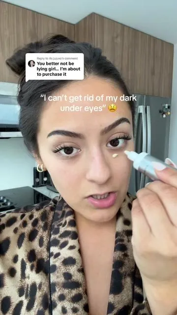 Replying to @its.jujuxo same lighting, no mascara, just amazing results. I got you guys!!! I am your local skincare dealer okay I just want y’all to feel confident. fixing my dark under eyes with Anua’s retinol caffeine cream in less than 7 days 🫶🏻 #dealsforyoudays #koreanskincare #anuaskincare #caffeineeyecream #darkundereye 
