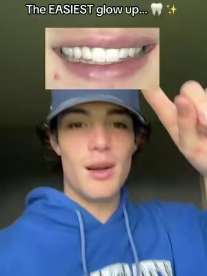 #dealsforyoudays 