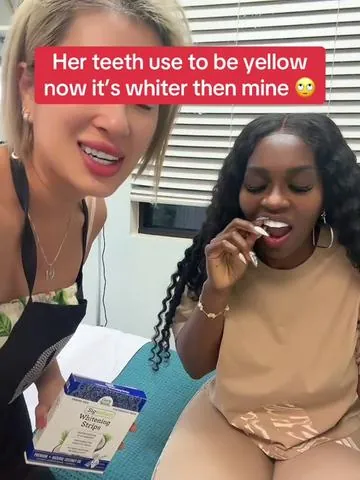 Her teeth use to be yellow now it’s whiter then mine 🙄#gurunanda #gurunandawhiteningstrips #whiteteeth #foryoupage #goviral #dealsforyou #tiktokshopcreatorpicks @Puneet Nanda bridge the gap 