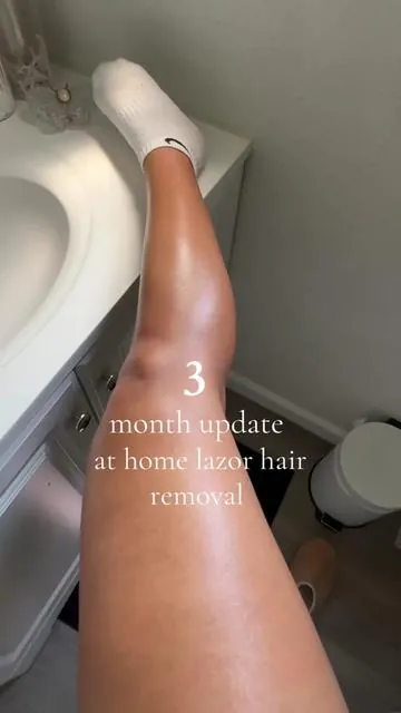 Completely bald & so so soooo smooth !!! 