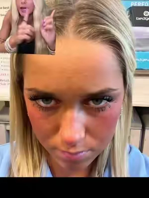 #fyp #viral #skincare #blowthisup 
