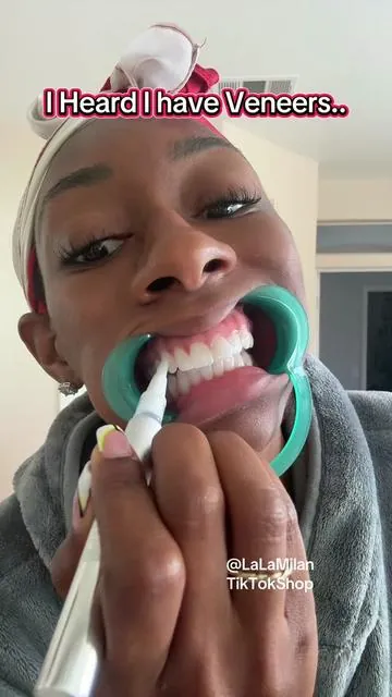 I keep my teeth white by whitening once a year. This kit has everything you need in one #gurunanda #teethwhitening #whiteteeth @GuruNanda LLC #dentalhygiene 