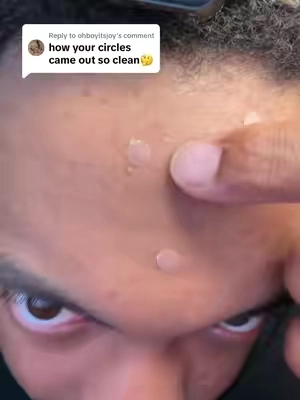 Replying to @ohboyitsjoy Favorite acne hack 🙌🏼 #skincarehack #acne #pimplepatch #skincare #hydrocolloidpatch #pimplepatchhack #hydrocolloidroll #hydrocolloid
