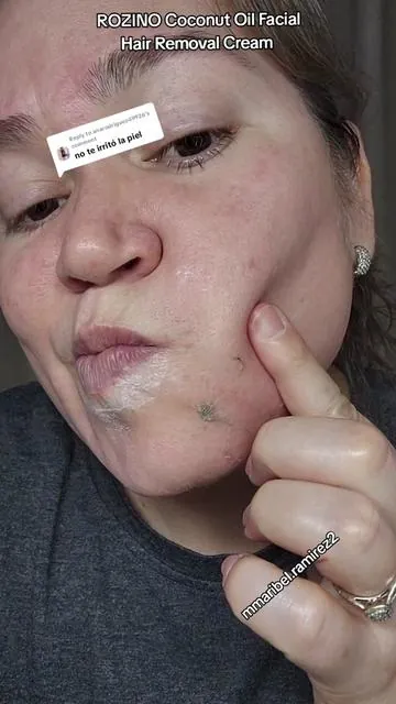 Replying to @anarodriguez49926 ME SORPRENDIO QUE NO ME IRRITO LA PIEL Y SI ME FUNCIONO A LA PRIMERA PUESTA🥰 ME ENCANTO LA VERDAD SUPER RECOMENDADO CHICAS 10 DE 10! Y ESTAN EL PAQUETE DE 2 BOTECITOS A UN SUPER PRECIO Y CON ENVIO GRATIS APROVECHENLOS. Y LUEGO REGRESAN Y ME COMENTAN COMO LES FUE😊 #rozino #hairremoval  #facialhair #facialhairremoval  #creatorsearchinsights 