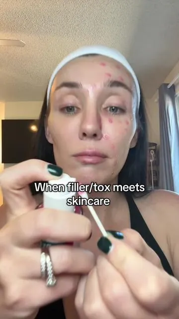 I wish I discovered this in my 20’s! @Dr.Melaxin Global #drmelaxin #drmelaxinpinkspicule #microneedling #koreanskincare #matureskin #skincare #ttsbeautybesties #ttsdelightnow #Tiktokshopcreatorpicks #tiktokshoprestock #tiktokshopnewarrivals #tiktokshopbacktoschool #tiktokshopblackfriday #tiktokshopcybermonday 