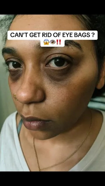 Avocado 🥑 eye mask ! work wonders for hard to get rid of under eyebags and dark under eyes.  #eyebags #darkeyecircles #freesample #foryoupage #tiktokmademebuyit #foru #musthaves 