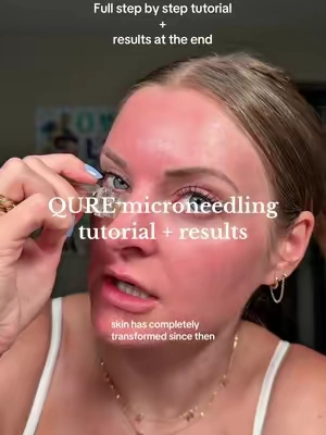 If you try microneedling at home make sure you read all the instructions and also sanitize and wash everything and also sleep with a fresh pillow case 🫶🏼🫶🏼🫶🏼  #qure #microneedling #skincare #hyperpigmentation #glowyskin 