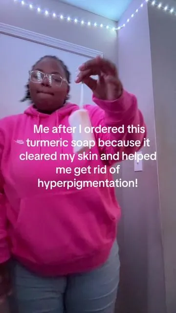 Definitely a 10/10 #fyp #foryou #foryoupage #fypシ #hyperpigmentation #clearskin #clearskinforgood 