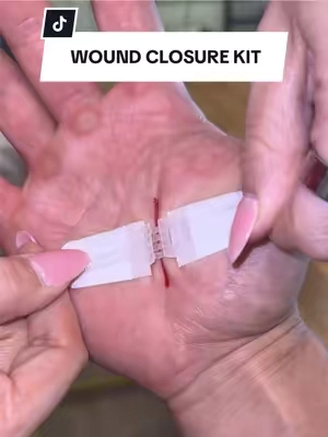 No stitches ✅ No ER bill ✅ need I say more… #tiktokshopcreatorpicks #woundcare #stitches #emergencypreparedness #firstaid 