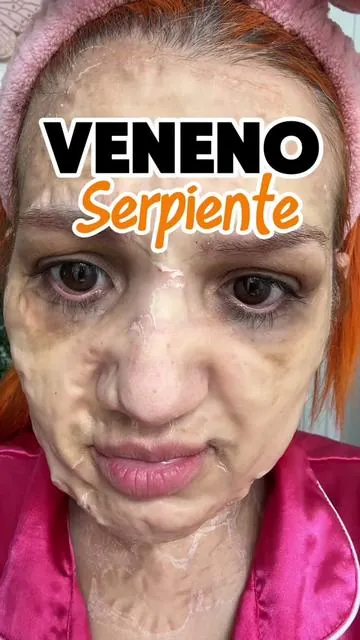 Respuesta a @Ana Jurado. Kit de 6 aplicaciones (1/mes) con péptidos inspirados en veneno de serpiente 🐍. Sigo este paso a paso para una piel con mejor textura y brillo natural. Guarda el video y únete a mi calendario de 6 meses. Disponible  en mi Shop.🛒 #CuidadoDeLaPiel #RutinaFacial #Péptidos #SnakePeptide   #pielluminosa 