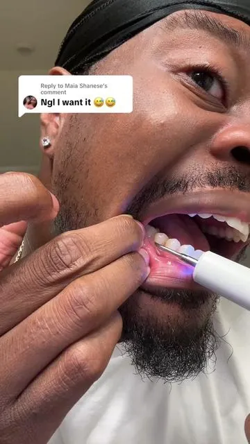 Replying to @Maia Shanese #teeth #tartar #teethcare 