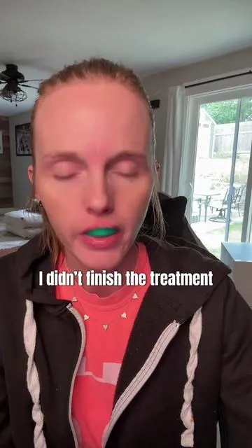 It’s been difficult find a good teeth whitening kit. I’ve tried all of them I believe at this point. This is the only one I’ve been able to see results this quickly and not cause any sensitivity to my teeth. And it was super easy to use. ##opalescence##teethwhitening##teethwhiteningstrips##oralhealth##tiktokshopcreatorpicks