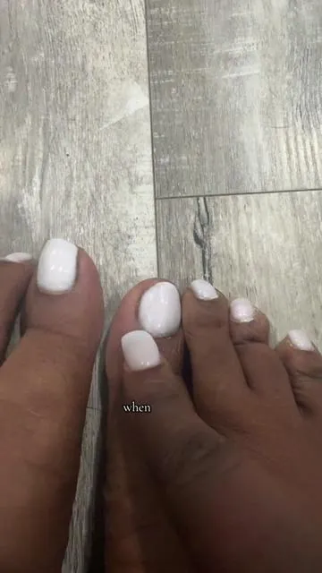 If your toenail turns black brow or yellow it a fungus. #pedicure #nailtok #toenail #footfungus #blackfridaydeals 