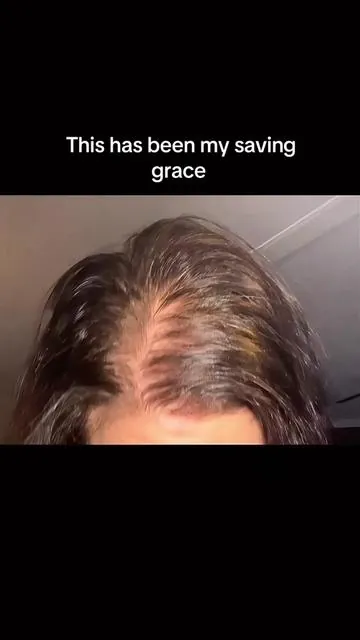 Awesome Product for thinning hair, bald spots & gray hair. #fyp #haircare #thinninghair #thinninghairsolution #hairtok @@boldify 