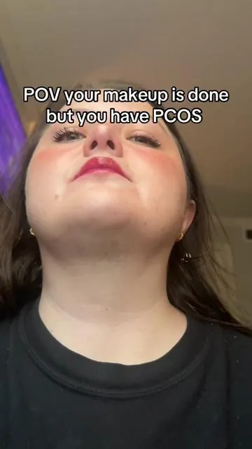 Couldn’t bring my beard as a plus 1 to my friend’s wedding #pcos #hirsutism #electricshaver #facialhairremoval 