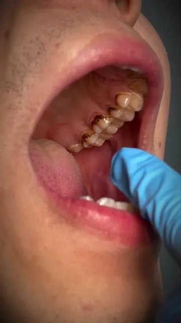 This toothpaste just KILL THE COMPETITION. LITERALLY.👽 #dental #iykyk #drdreamwhite #hydroxyapatite #holygrail 