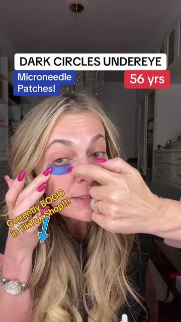 Under eye circles and crows feet…will help with appearance of under eye bags with caffeine but doesn’t reverse them #undereye #darkcircles #undereyecircles @Qure Skincare 