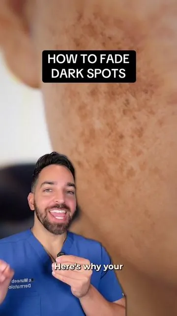 Dark spots 101: it’s complex but once you understand what causes them, it’s easier to treat them! #remedyfordarkspots #darkspots #discoloration #darkspotserum 