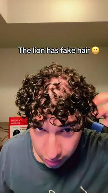#hairgrowth #hairloss #haircare 