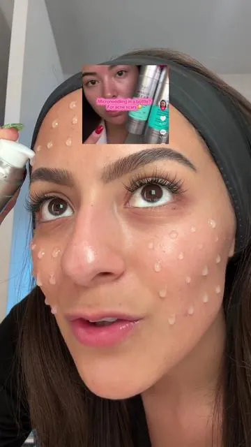 Med spa results at home without the painful and expensive procedures? Korean skincare is just different! @Rael Beauty’s Microcrystal Activated PM Serum 2,000 + 5,000 bundle now available on TikTok shop for 20% off 🤩 #koreanskincare #kbeauty #skincarejourney #acnescar #raelpartner