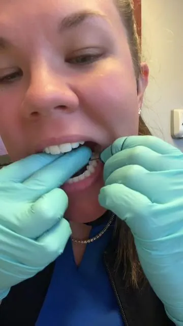 I highly encourage all of my patients to floss their teeth! This one has free shipping! @BURST Oral Care 