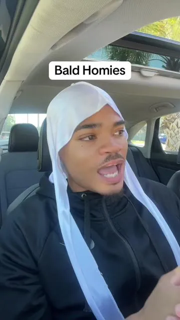 karma is crazy #hairloss #bald #fyppppppppppppppppppppppp 