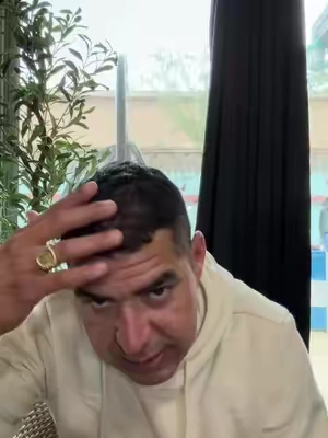 Si padeces d la caída del cabello #paratiiiiiiiiiiiiiiiiiiiiiiiiiiiiiiiiii #TikTokshopbacktoschool #fypシ゚viral #tiktok 