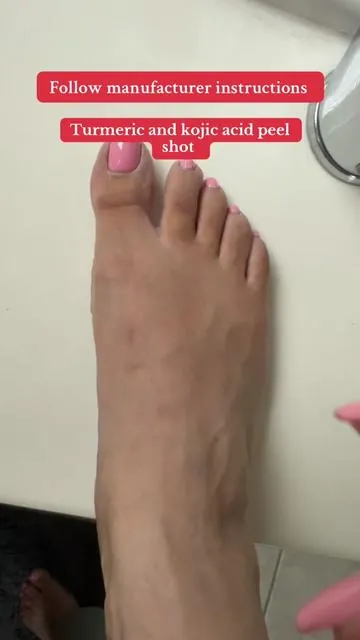 Amazing how it works #selfiequeen1977 #peelshot #trending #usa #tiktokshopcreatorpicks @Dr Melaxin Official 