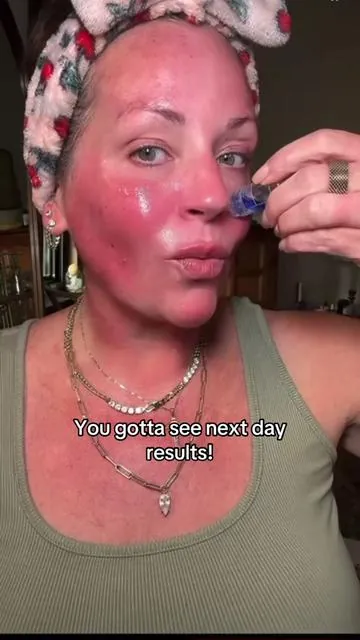 Micro-infusion is fantastic for dark spots, texture, large pores, elasticity, fine lines and wrinkles, acne scars #microneedling #microinfusion #darkspottreatment #antiagingtreatments #qureskincare @Qure Skincare 