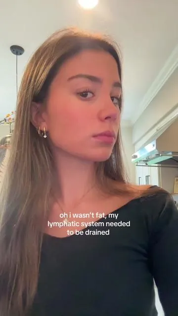 finally have a snatched face 
