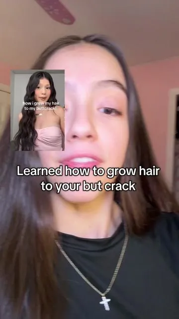 The ingredients in these for hair growth is insane #tiktokshopcreatorpicks #tiktokblackfriday #tiktokcybermonday #hairgrowth #hairgrowthtips 